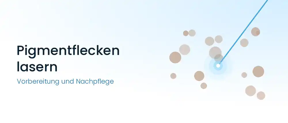 Grafik: Laserstrahl trifft auf einen von mehreren bräunlichen Pigmentflecken